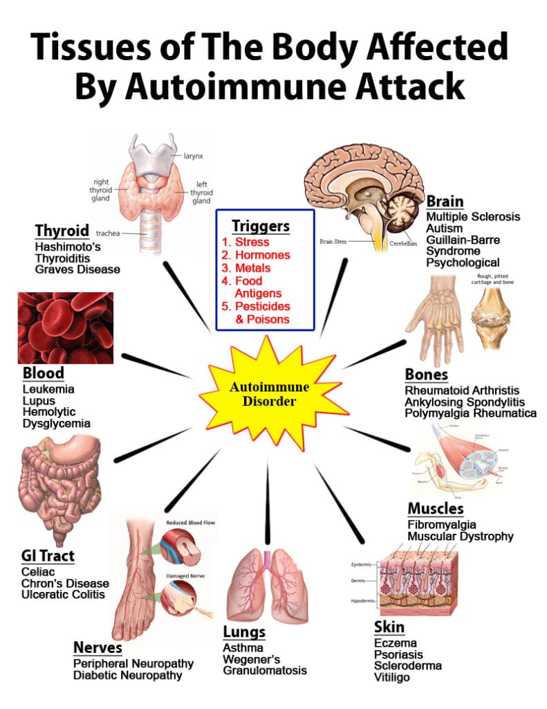autoimmune illnesses