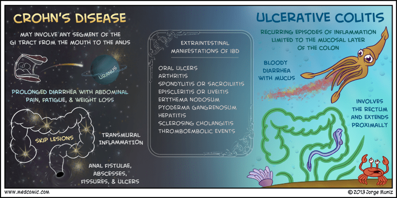 immune system indicators in ulcerative colitis